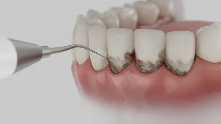 Reliable Emergency Dentist contractor in Dyer, IN by Smile Center Dentistry